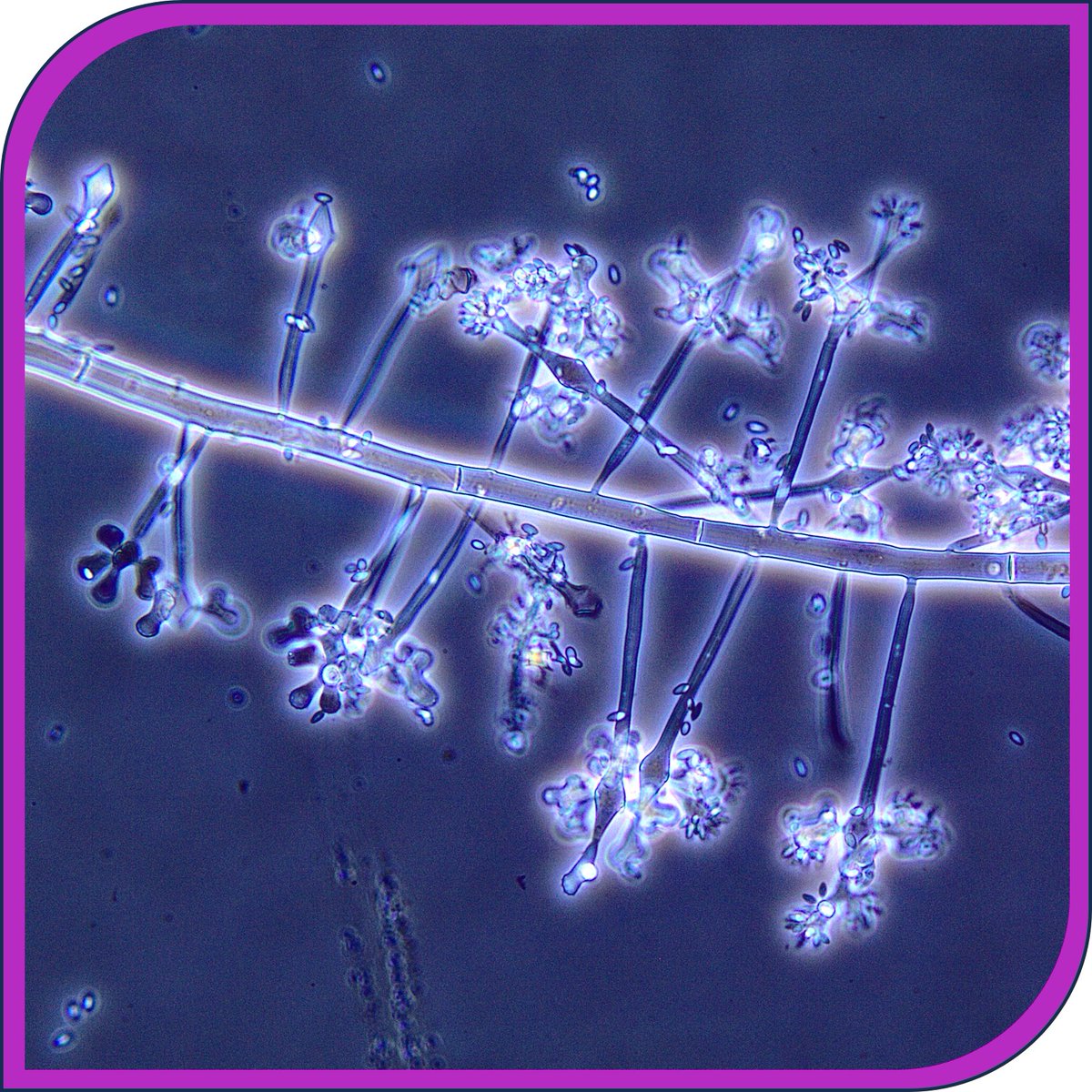 BCCM Collections (@bccmcollections) on Twitter photo BCCM/MUCL presents: 
Botryosporium longibrachiatum (Oudemans) Maire
MUCL 58356 
This fairly rare #mold can be found on other molds or parasitizing plants, especially in greenhouses. This specimen is from shiso (Perilla frutescens var. crispa)
#microbiology <a href="/belspo/">Belspo</a> @UCLouvain_be BCCM/MUCL presents: 
Botryosporium longibrachiatum (Oudemans) Maire
MUCL 58356 
This fairly rare #mold can be found on other molds or parasitizing plants, especially in greenhouses. This specimen is from shiso (Perilla frutescens var. crispa)
#microbiology <a href="/belspo/">Belspo</a> @UCLouvain_be