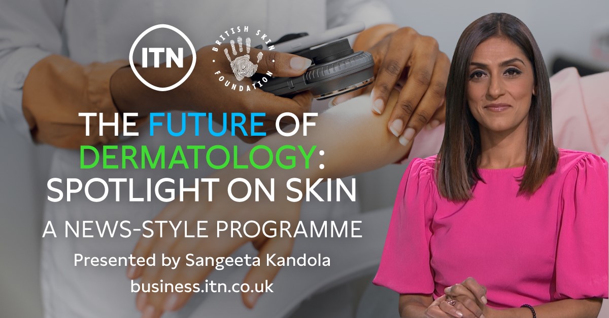 ITN Business (@itnbusiness) on Twitter photo Tomorrow we launch āThe #FutureOfDermatology: #SpotlightOnSkinā, our programme made with <a href="/BSFcharity/">British Skin Foundation</a>.
Presented by <a href="/SangeetaKandola/">Sangeeta Kandola</a>, it highlights the research and breakthroughs improving lives both physically and emotionally.
Watch the programme on the ITN Business hub tomorrow. Tomorrow we launch āThe #FutureOfDermatology: #SpotlightOnSkinā, our programme made with <a href="/BSFcharity/">British Skin Foundation</a>.
Presented by <a href="/SangeetaKandola/">Sangeeta Kandola</a>, it highlights the research and breakthroughs improving lives both physically and emotionally.
Watch the programme on the ITN Business hub tomorrow.