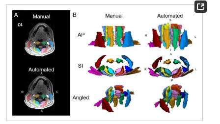 CU Physical Medicine (@cuphysmed) on Twitter photo #Newpub in <a href="/J_Imaging_MDPI/">J. Imaging</a> by <a href="/CUPhysMed/">CU Physical Medicine</a> faculty <a href="/DrAndrewCSmith/">Andrew C. Smith, PT, DPT, PhD</a> & team on MuscleMap: An Open-Source, Community-Supported Consortium for Whole-Body Quantitative #MRI of #Muscle. pubmed.ncbi.nlm.nih.gov/39590726/ #Newpub in <a href="/J_Imaging_MDPI/">J. Imaging</a> by <a href="/CUPhysMed/">CU Physical Medicine</a> faculty <a href="/DrAndrewCSmith/">Andrew C. Smith, PT, DPT, PhD</a> & team on MuscleMap: An Open-Source, Community-Supported Consortium for Whole-Body Quantitative #MRI of #Muscle. pubmed.ncbi.nlm.nih.gov/39590726/