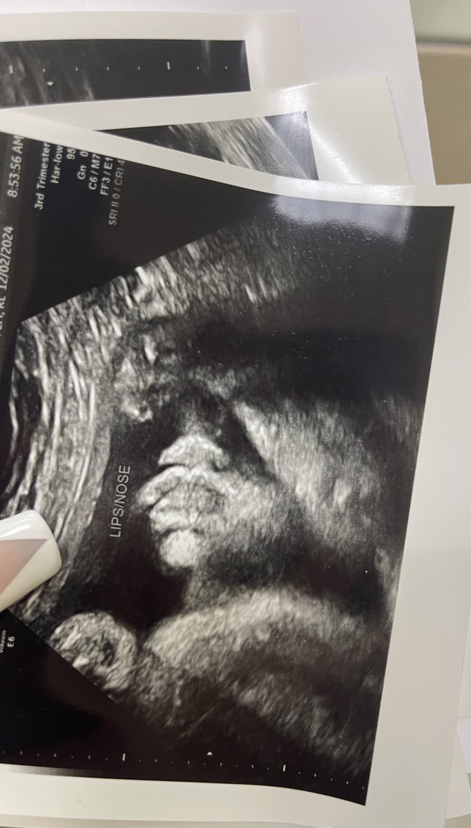 _Cede02's tweet image. Drs appointments &amp;amp; dates. 🩵🩵 
Big boy is 5 lbs already &amp;amp; still has 7 weeks to go 😭