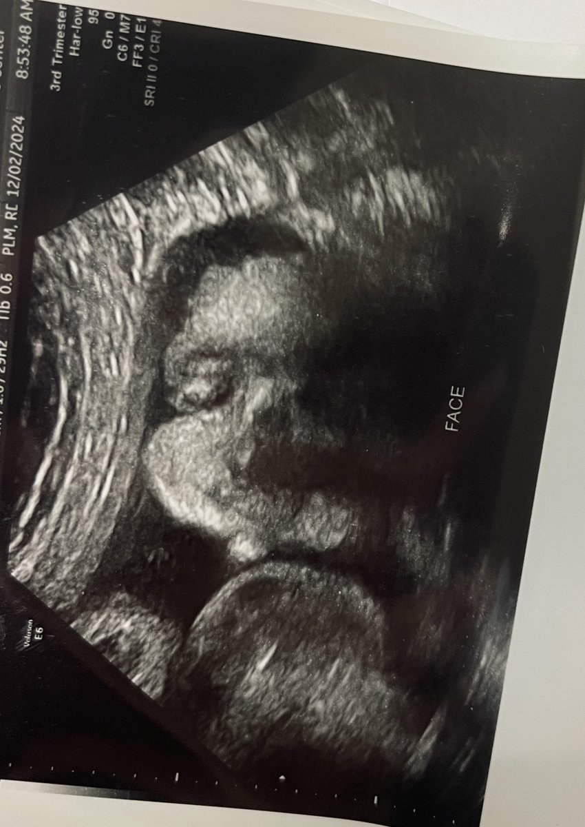 _Cede02's tweet image. Drs appointments &amp;amp; dates. 🩵🩵 
Big boy is 5 lbs already &amp;amp; still has 7 weeks to go 😭