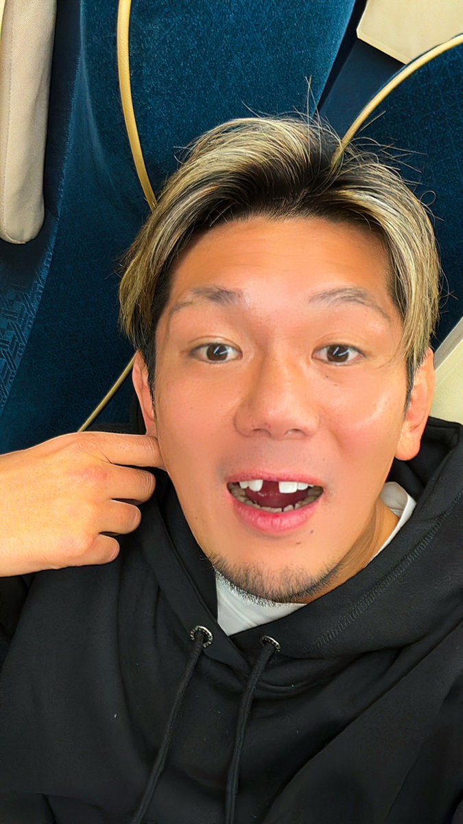 1_kouzi's tweet photo. 調子こいとったら、モートンベンと闘わんでも前歯失ってもうたわ。 https://t.co/0vLMinslGe