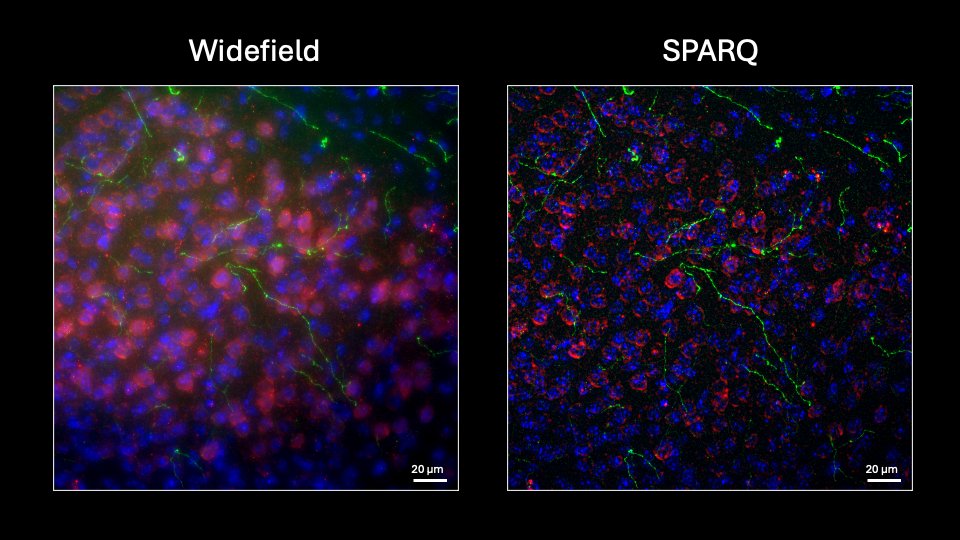 Excited for the upcoming <a href="/ASCBiology/">American Society for Cell Biology</a> 2024 meeting? 👋 Stop by booth 837 in San Diego (Dec 14–18) to see our SPARQ widefield optical sectioning module in action on the latest multi-camera microscope from <a href="/CairnGmbH/">Cairn GmbH</a> 🔬.
Stay tuned for our poster announcement that dives deeper into