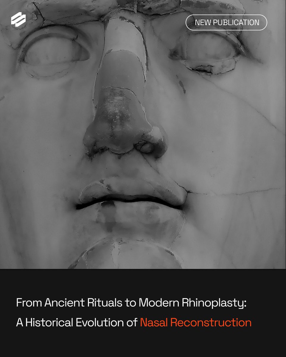 New publication alert! 

The Plastic Surgery community has published its first article, "From Ancient Rituals to Modern Rhinoplasty: A Historical Evolution of Nasal Reconstruction"! 👃

#PlasticSurgery #Rhinoplasty #History #Science