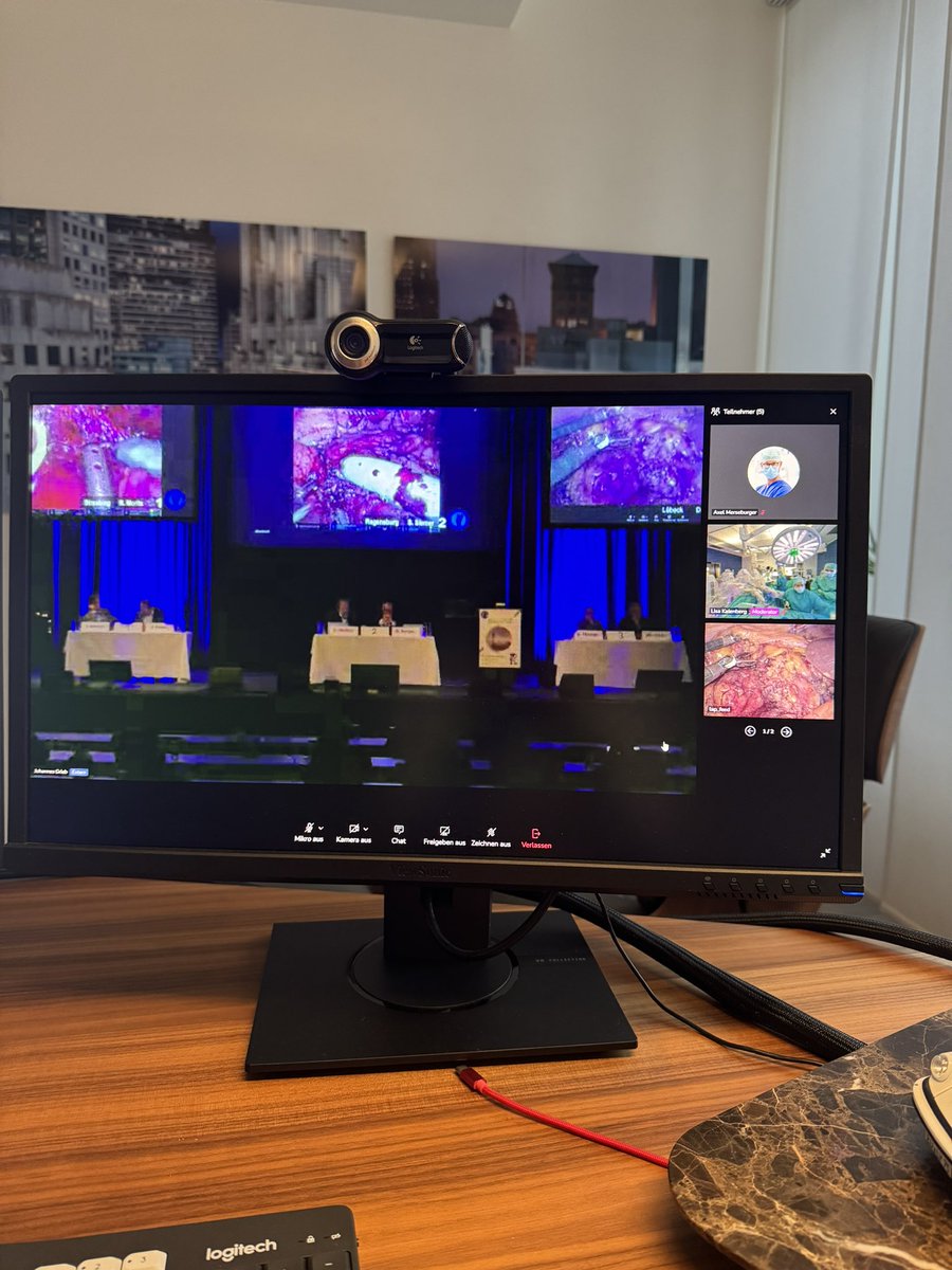 Medtronic Hugo RAS is one of the newest robotic system for minimal invasive surgery. We are honored to join the live surgery session #Hugo robotic assisted partial nephrectomy at German robotic annual meeting  #Straubingen 👏🏼 <a href="/OsmonovDr/">Prof. Dr. Daniar Osmonov, FECSM</a> 💪 #DRUS #DRUS2024 #livestream <a href="/UKSH_KI_HL/">Universitätsklinikum Schleswig-Holstein</a>