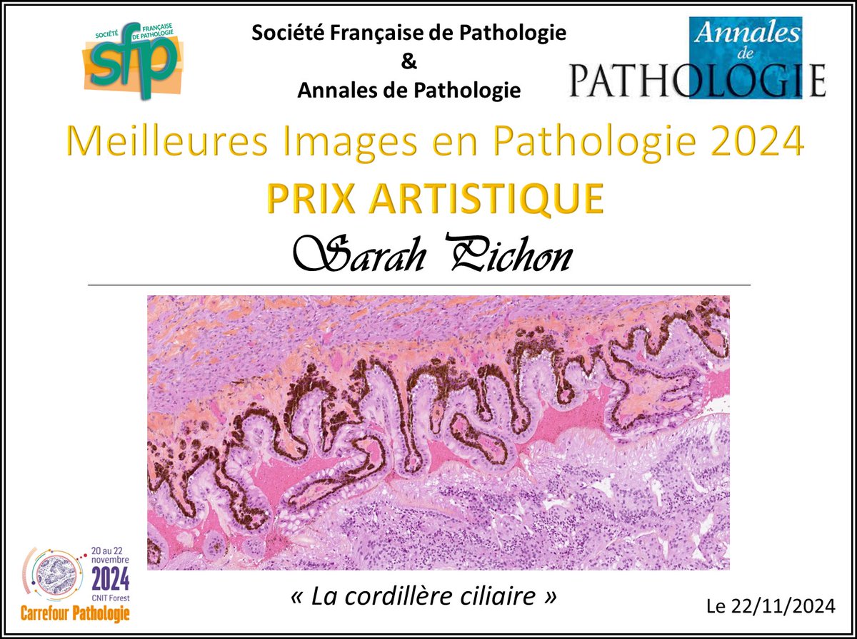 Annpathol's tweet photo. Félicitations 🎉🍾 à nos 2 gagnantes du concours photo @Annpathol - @SFPathol 2024 :
- Sarah Pichon pour le Prix Artistique 🎨🖼️
- Clémence Yguel pour le prix Pédagogique 🎓📖
#CarrefourPathologie2024 #CP2024 https://t.co/Fob8eigux8