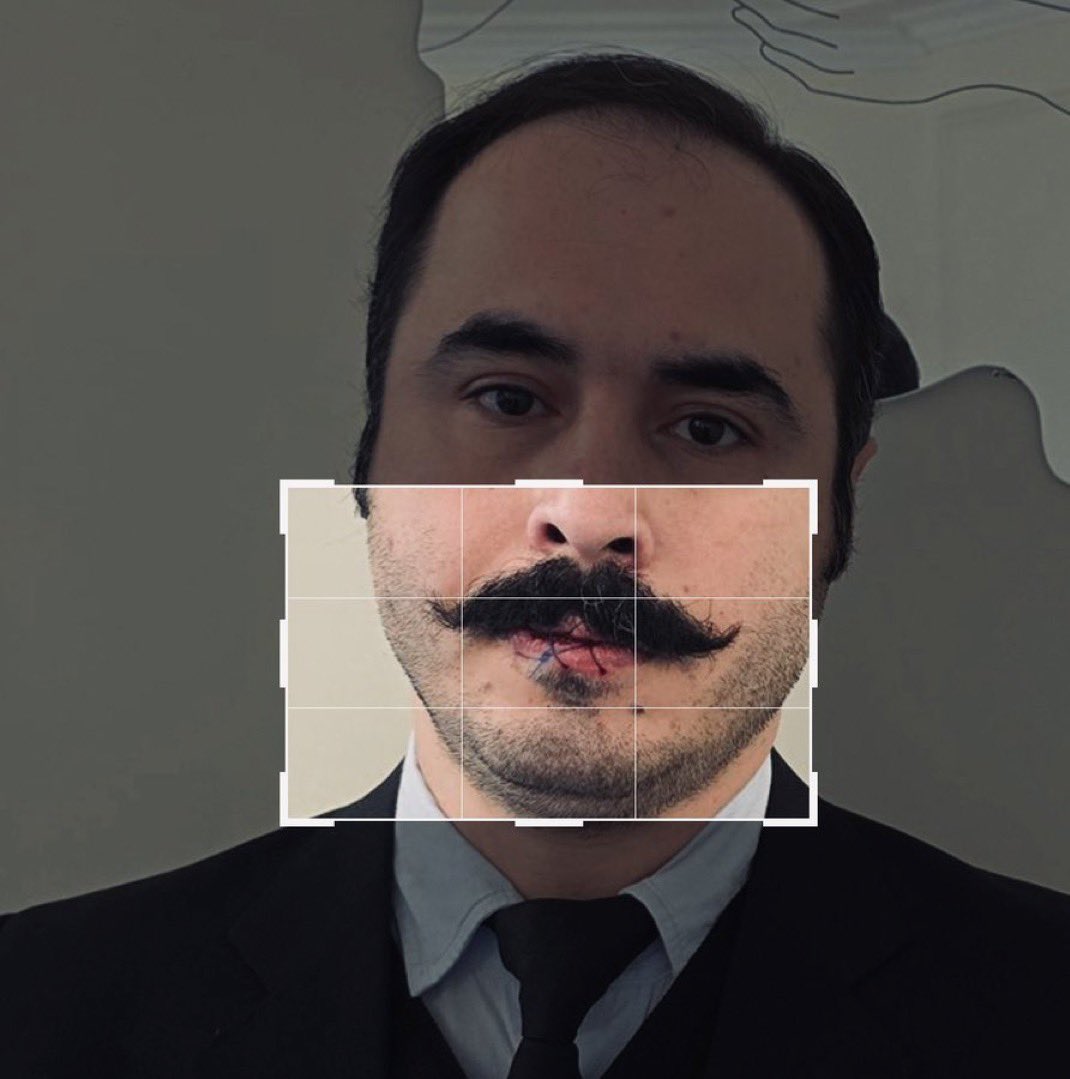 <a href="/HosseinRonaghi/">Hossein Ronaghi</a> Part of the message from Kianoosh Sanjari, a freedom fighter and former political prisoner:

‘No one should be imprisoned for expressing their beliefs. Protest is the right of every Iranian citizen.’

After Kianoosh’s death, Hossein has sewn his lips together and gone on hunger