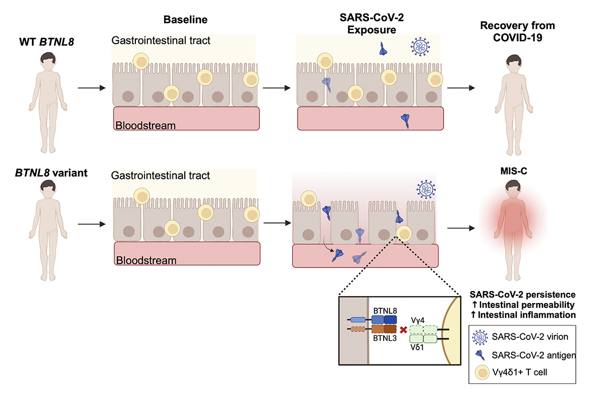 Journal of Experimental Medicine (@jexpmed) on Twitter photo Bellos, Santillo, <a href="/SanchoShimizu/">Vanessa Sancho-Shimizu</a> et al. identify an enrichment of rare, damaging variants in BTNL8 in MIS-C patients resulting in impaired Vγ4⁺ γδ T cell engagement associated with altered gut homeostasis which may contribute to the pathogenesis of MIS-C. hubs.la/Q02Z9_kK0 Bellos, Santillo, <a href="/SanchoShimizu/">Vanessa Sancho-Shimizu</a> et al. identify an enrichment of rare, damaging variants in BTNL8 in MIS-C patients resulting in impaired Vγ4⁺ γδ T cell engagement associated with altered gut homeostasis which may contribute to the pathogenesis of MIS-C. hubs.la/Q02Z9_kK0