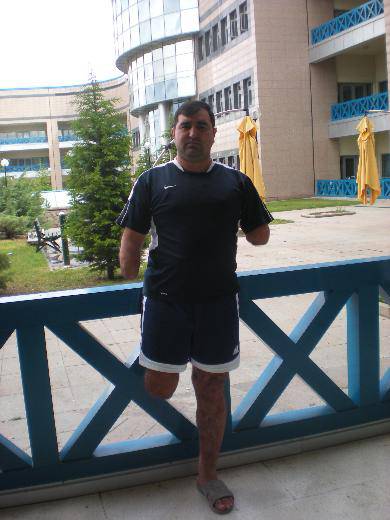 "2007’de Şırnak’ta çatışmada mayına bastım. Sol kolum dirsek üstünden, sağ kolum dirsek altından ve sağ bacağım diz üstünden koptu. Sol gözümde de yüzde 90 görme kaybı var.

Erzak götüren helikopterin tarandığı söylendi. Özel Hareket Taburu olarak Teke Tepe Mevkii’ne gittik. ⤵️