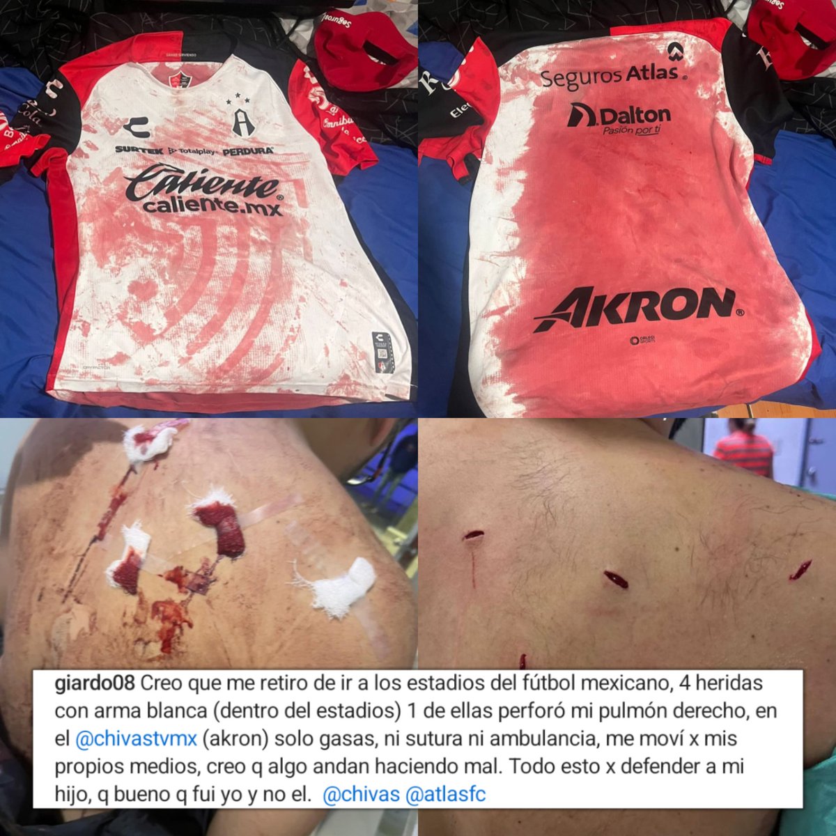 aloatlas's tweet photo. Lamentable que siga ocurriendo esto en los estadios.

La rivalidad se debe quedar en la cancha, ESTO NO TIENE JUSTIFICACIÓN.

Pero lo peor es que como pasó en un estadio que será mundialista, la @LigaBBVAMX hará como que no sucedió nada. https://t.co/tgrQBOD8iv