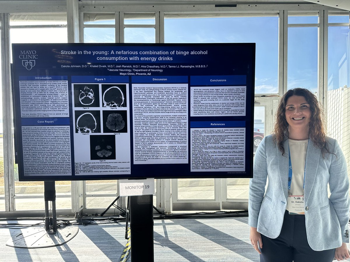 Tamra Ranasinghe, MBBS, FAHA (@tamrar1) on Twitter photo A compelling case of stroke in a young patient linked to the hazardous mix of binge drinking and energy drinks ⚡🥃 Brilliantly presented by Dr. Johnson <a href="/dakotaarizona24/">Dakota Johnson</a> #vascularneurologyfellow Dr. Dweik, Dr. Ransick & Dr. Chaudhary 👏🏾🎊 <a href="/MayoAZneurores/">Mayo Clinic Neurology Residency ARZ</a> <a href="/MayoClinicNeuro/">Mayo Clinic Neuro</a> A compelling case of stroke in a young patient linked to the hazardous mix of binge drinking and energy drinks ⚡🥃 Brilliantly presented by Dr. Johnson <a href="/dakotaarizona24/">Dakota Johnson</a> #vascularneurologyfellow Dr. Dweik, Dr. Ransick & Dr. Chaudhary 👏🏾🎊 <a href="/MayoAZneurores/">Mayo Clinic Neurology Residency ARZ</a> <a href="/MayoClinicNeuro/">Mayo Clinic Neuro</a>
