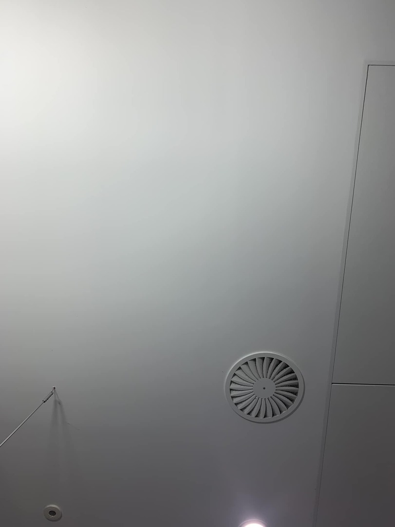 A routine visit to Taunton hospital turned in to a night in hospital🙄 A lump had appeared where last weeks operation had entered the femoral artery… it turned out to be a psudoaneurysm which needed sorting out. Home tomorrow 😁 instagr.am/p/DCrxCxSo4T8/