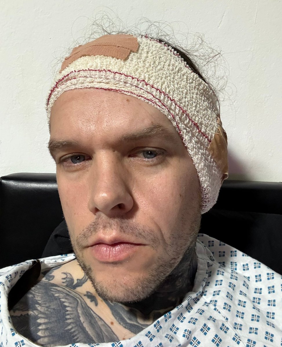 Mazmorbidfetish's tweet photo. Well despite this month having some immense highs with friends and winning the @UkFetishAwards.
It also brought some pretty harsh lows. Todays finale to the unlucky 3 was having my iPhone 15pro stollen.

I am now in need of some help and have opened up a @gofundme (link below) for anyone to offer me some help.

In advance I appreciate any help you can offer.
Both financially and emotionally.
Though I do kindly ask, please don't bring up the subjects unless I open a conversation directly with you about them. I need to avoid negativity right now.

Even if you cant donate, your support, likes and of course RT's will help my spirits 🖤

"I really didn't want to do this to be honest, but having my newly-upgraded phone stolen is the just latest in a series of unpleasant events, and I am now pretty desperate.

Normally, I would work hard in order to keep myself, but I’m feeling burnt out and really need time out to recover from recent brain surgery.

A lot of you will know I was in hospital this week to remove an abscess from inside my ear which was slowly spreading to my brain. The surgeon said the operation was difficult and the abscess was alarmingly close to my brain, but thankfully it has been removed and, with rest, I will recover. Though the chances of it re-occurring for a 3rd time are unknown.

In addition to this, I went to film with a production company in June. I flew to another country and it all cost me £600ish for last minute flights etc. They said I could have the raw footage 6 months later, but now they are refusing to give me it and now want money off me to pay for someone to edit it, going against the word they gave me.

All of this has left me very drained and burdened financially, so I am humbly asking for any donations to help me until I get back on my feet again, which I hope won’t be too long. I will be grateful for anything you can give to help me through this exceptionally tough time.

Thank you for listening."

https://t.co/udYZKdiFf9