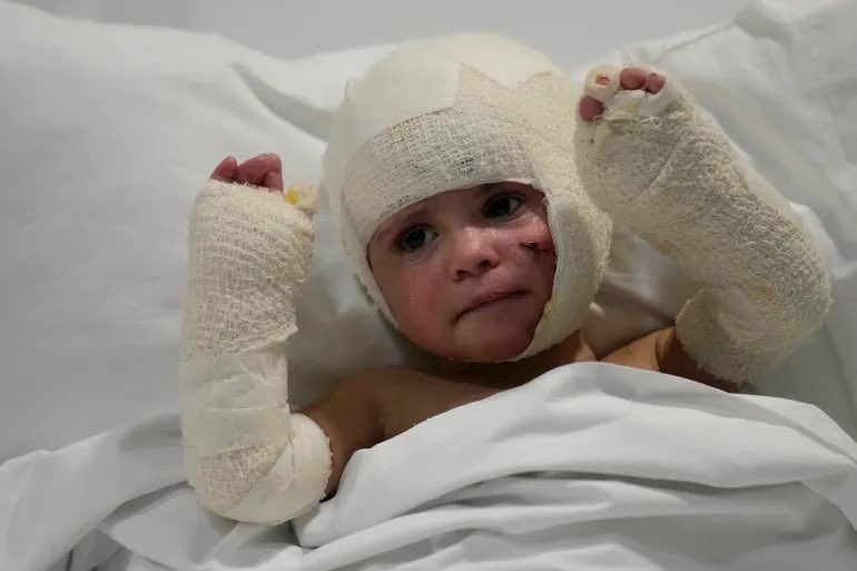 Ya se ha sobrepasado los 45.000 palestinos asesinados como mínimo en Gaza. Seguro que serán miles más.

El Ministerio en Gaza informó  que al menos 44.056 palestinos han muerto y 104.268 han resultado heridos desde el 7 octubre de 2023. 

El  70% de los muertos son mujeres, niños