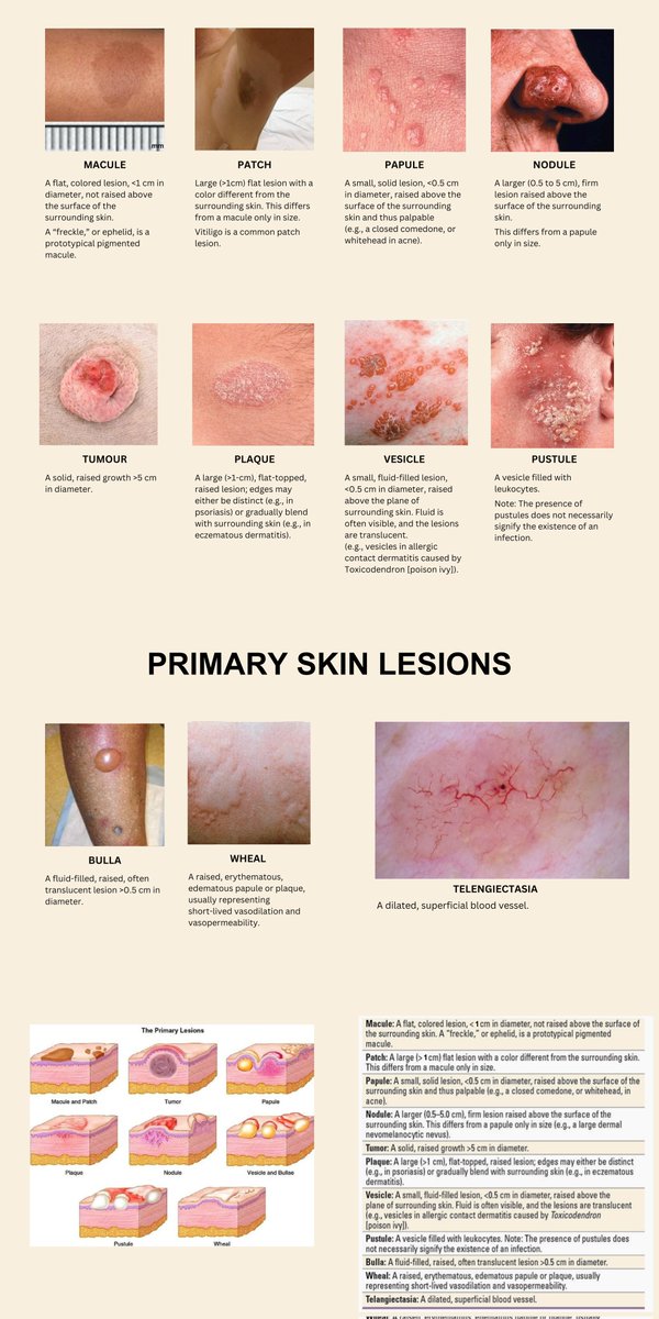 🌟 PRIMARY SKIN LESIONS