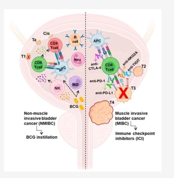 lga16f's tweet photo. Delighted that our review has been published @MDPIOpenAccess. Hope that it will be useful in updating immunotherapy in bladder cancer. https://t.co/Fu6YlhBfxw