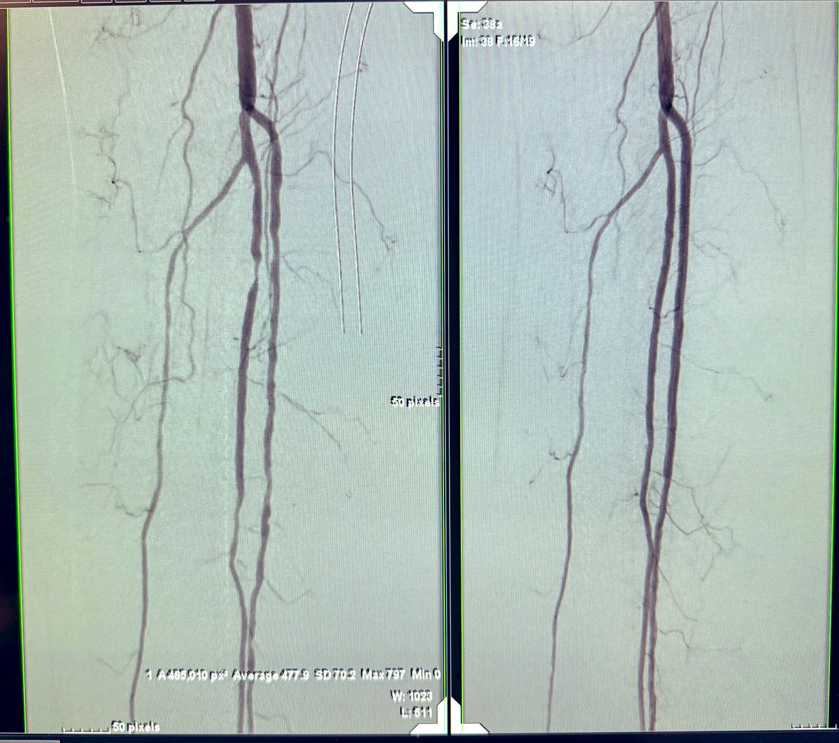 Robert A Lookstein MD, MHCDL tweet media