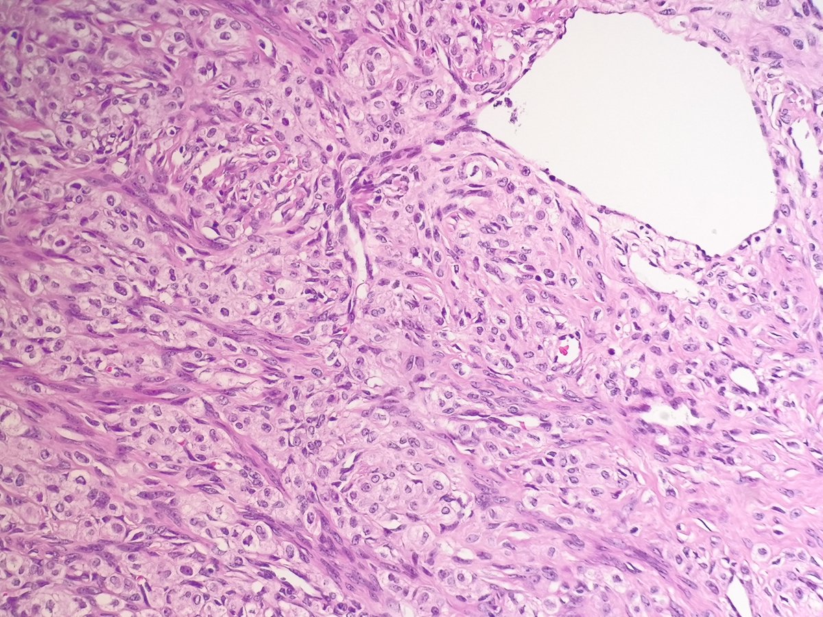 Miruna Popescu, MD tweet media