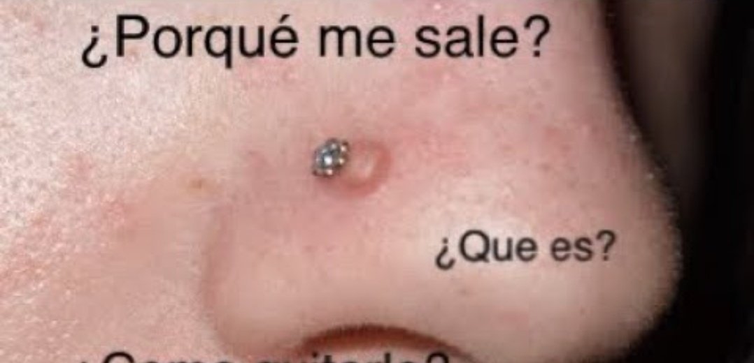 brumalfoyy tweet media