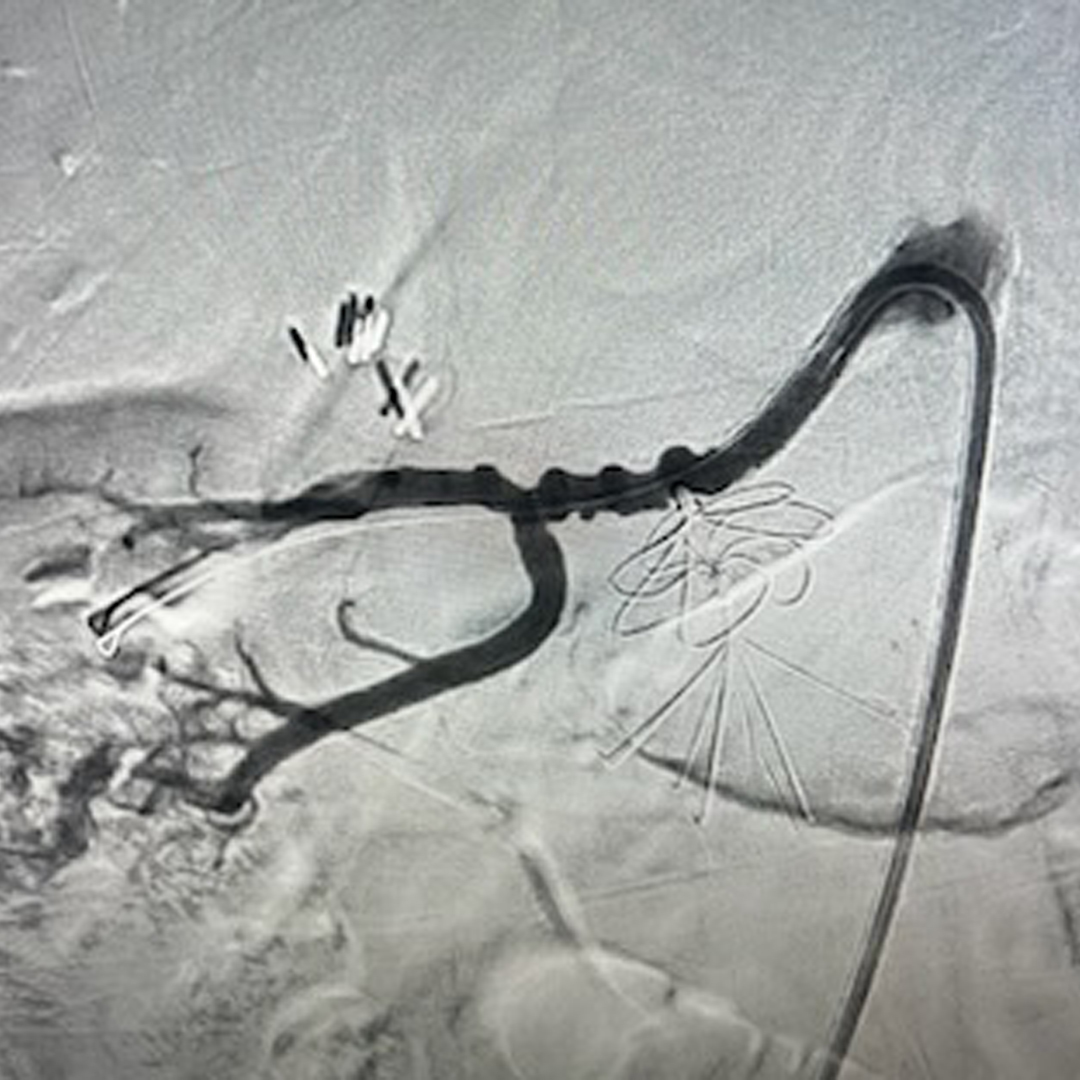 Lakeland Vascular Institute tweet media