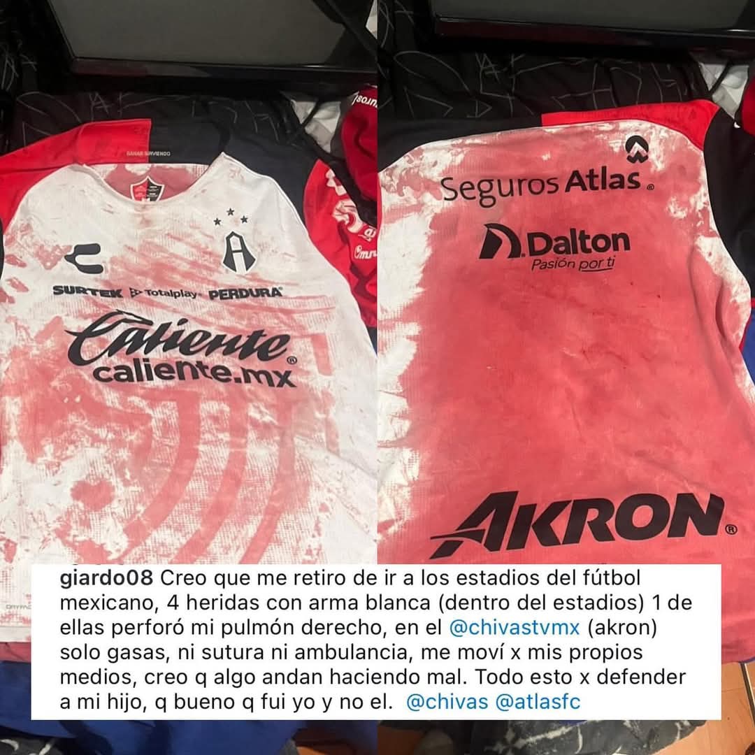 vikingo_51's tweet image. @hagala_ nada que aclarar las pruebas son consistentes
@LigaBBVAMX
@FMF protegeran a @Chivas como acostumbran.
El fan id de @MikelArriolaP ahi es inexistente.