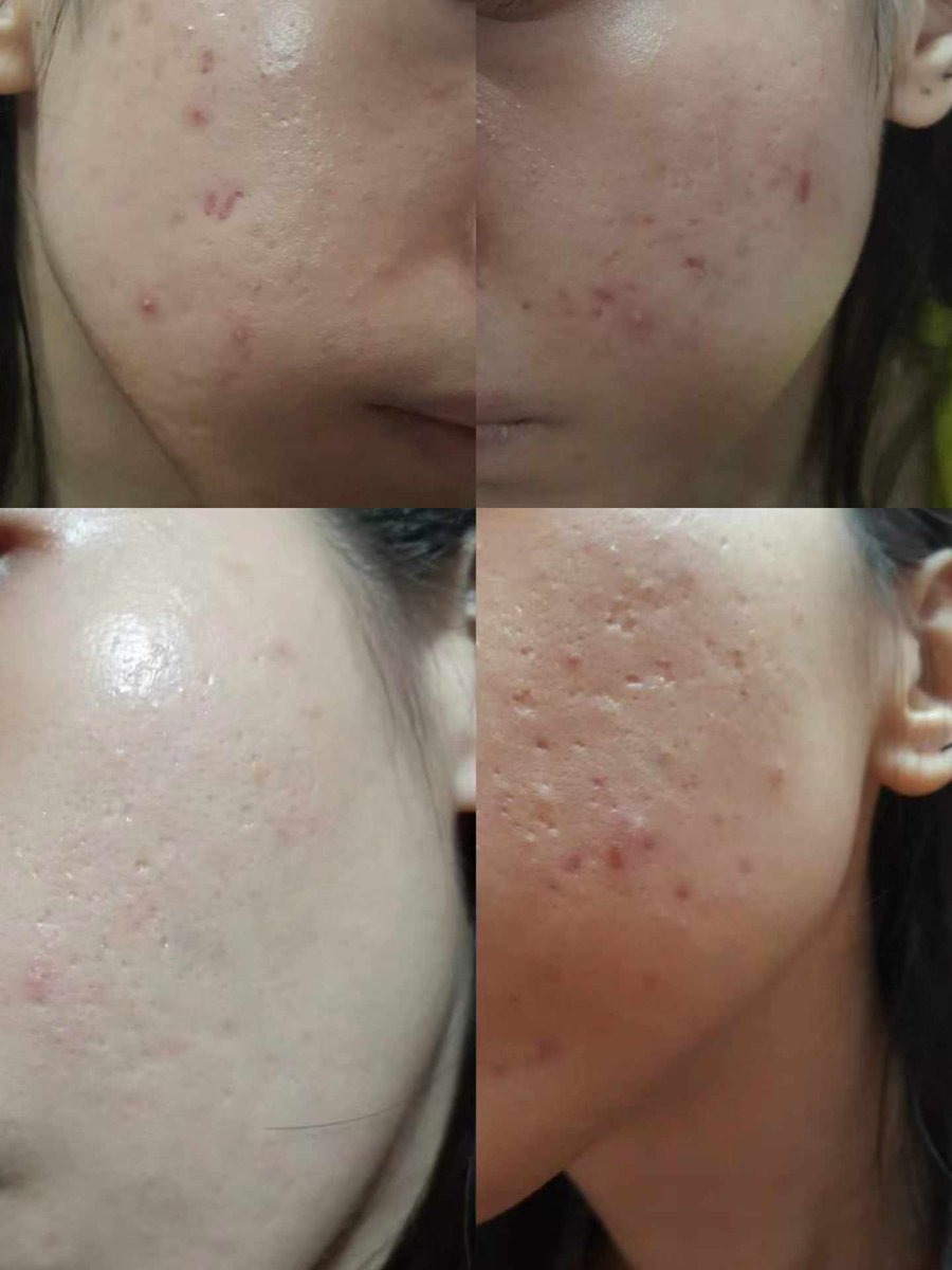 JennYNGKALENG's tweet photo. Woo. What a amazing product that i even use, now my skin became smoother than before.
And it can improve you skin of belly,  you guys need to try it 😍💕

Massage me to order. https://t.co/ulRAjJ1xJ4