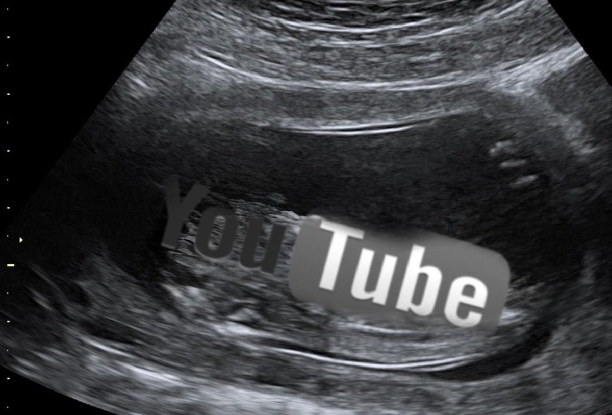 It’s been long overdue &amp; after yrs of family &amp; friends asking, we’re finally excited to announce the arrival of… our YouTube channel. Please subscribe 🙏

m.youtube.com/@KasiaBodurkaB…

#Baja #Cabo #LaPaz #BajaRealEstate #CaboRealEstate #CaboLife #BajaLife