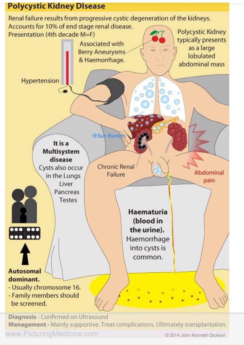 🫘Polycystic kidney disease

Grepmed