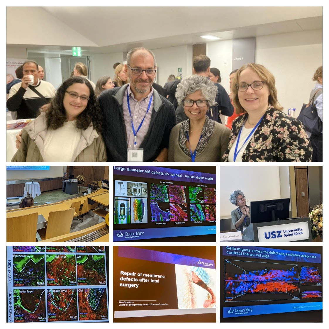 Dr. Tina Chowdhury (@ttchowdhury) on Twitter photo USZ <a href="/UZH_en/">University of Zurich</a> brought together a multi-disciplinary team of clinicans <a href="/PrenatalTherapy/">Anna David</a> and scientists <a href="/QMULSciEng/">QMUL Sci & Eng News</a> to tackle the challenges of fetal therapy to prevent #PPROM <a href="/ppromfoundation/">THE PPROM FOUNDATION</a>
Great speakers <a href="/jandeprest/">jandeprest</a>, Prof Nicole Ochsenbein-Kölble, Martin Ehrbar <a href="/Unispital_USZ/">Unispital_USZ</a> USZ <a href="/UZH_en/">University of Zurich</a> brought together a multi-disciplinary team of clinicans <a href="/PrenatalTherapy/">Anna David</a> and scientists <a href="/QMULSciEng/">QMUL Sci & Eng News</a> to tackle the challenges of fetal therapy to prevent #PPROM <a href="/ppromfoundation/">THE PPROM FOUNDATION</a>
Great speakers <a href="/jandeprest/">jandeprest</a>, Prof Nicole Ochsenbein-Kölble, Martin Ehrbar <a href="/Unispital_USZ/">Unispital_USZ</a>