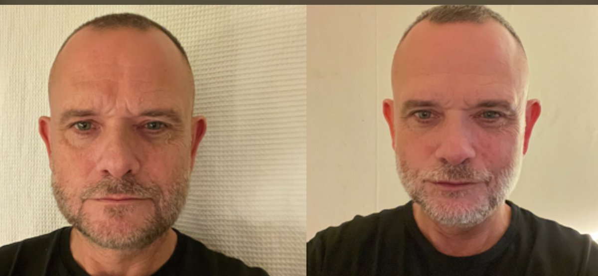 jasonRFC's tweet image. #weightlossjourney #fitter #healthylifestyle photo 5 weeks apart