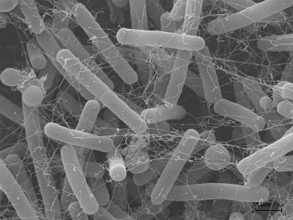🌍 #WAAW2024

Chlorotonil A, ein aus Bodenbakterien isolierter Naturstoff, zeigt Wirksamkeit gegen Problemkeime wie C. difficile, S. aureus und den Malariaparasiten. Forschende am HIPS entdecken zudem neue Myxobakterien mit großem Potenzial. 🧪

👉 dzif.de/de/neuer-wirks…