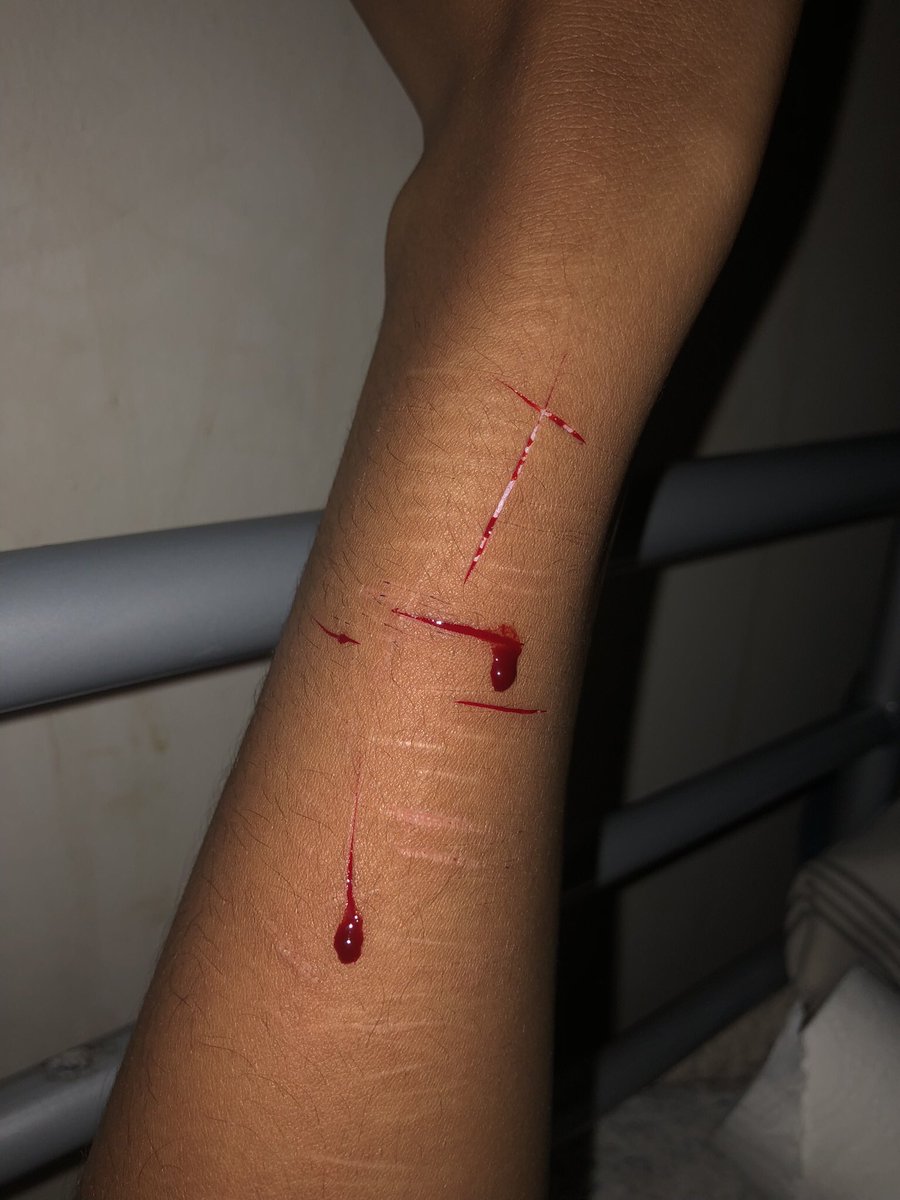 bl0od7y's tweet photo. last small styro set (wrist edition) #gettingbold 🧵!! https://t.co/4VrR01ELK3