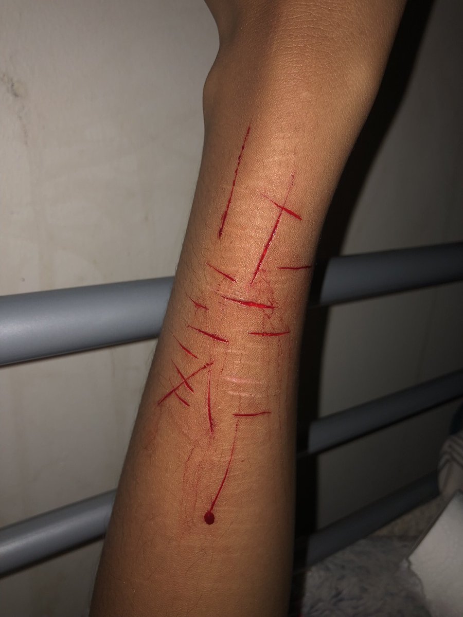 bl0od7y's tweet photo. last small styro set (wrist edition) #gettingbold 🧵!! https://t.co/4VrR01ELK3
