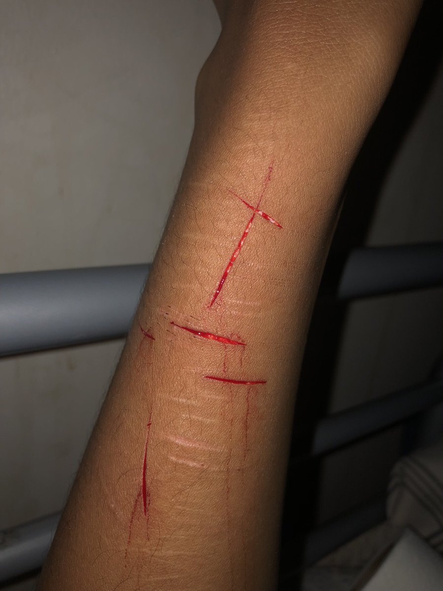 bl0od7y's tweet photo. last small styro set (wrist edition) #gettingbold 🧵!! https://t.co/4VrR01ELK3
