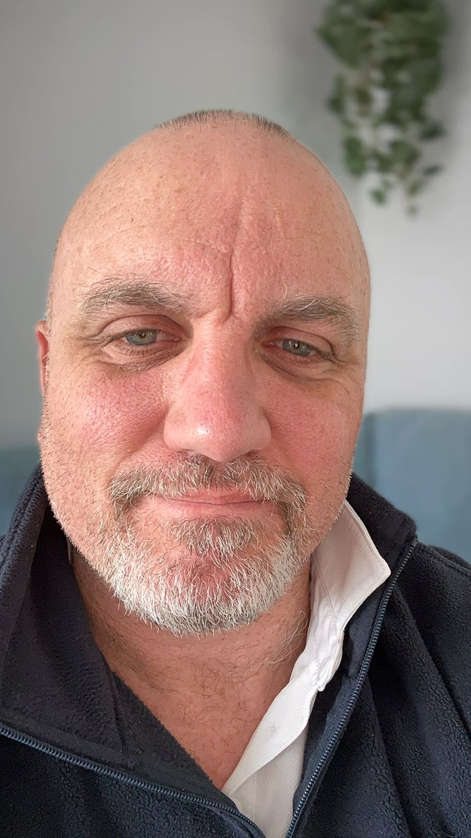 RochfordRugby's tweet image. Chairman Steve’s Movember journey is in full swing. Show your support for men’s health and make a difference by donating to his Mo Space here: uk.movember.com/mospace/152908….

#Movember2024 #MensHealthMatters #SupportTheMo #UKCharity #ProstateCancerAwareness #RochfordRugbyClub