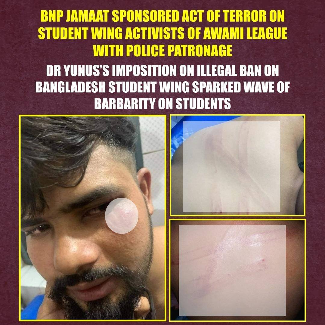 Md Faisal, a vice president of a college unit #BSL in #Bhola Zila, endured brutal #torture as armed activists of <a href="/bdbnp78/">Bangladesh Nationalist Party-BNP</a>  and <a href="/BJI_Official/">Bangladesh Jamaat-e-Islami</a> attacked him ruthlessly. 

Earlier, circumventing all legal procedure, <a href="/ChiefAdviserGoB/">Chief Adviser of the Government of Bangladesh</a>- led regime issued a decree slapping a ban on the