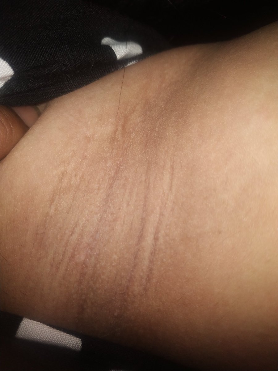 aku ya aku tweet media