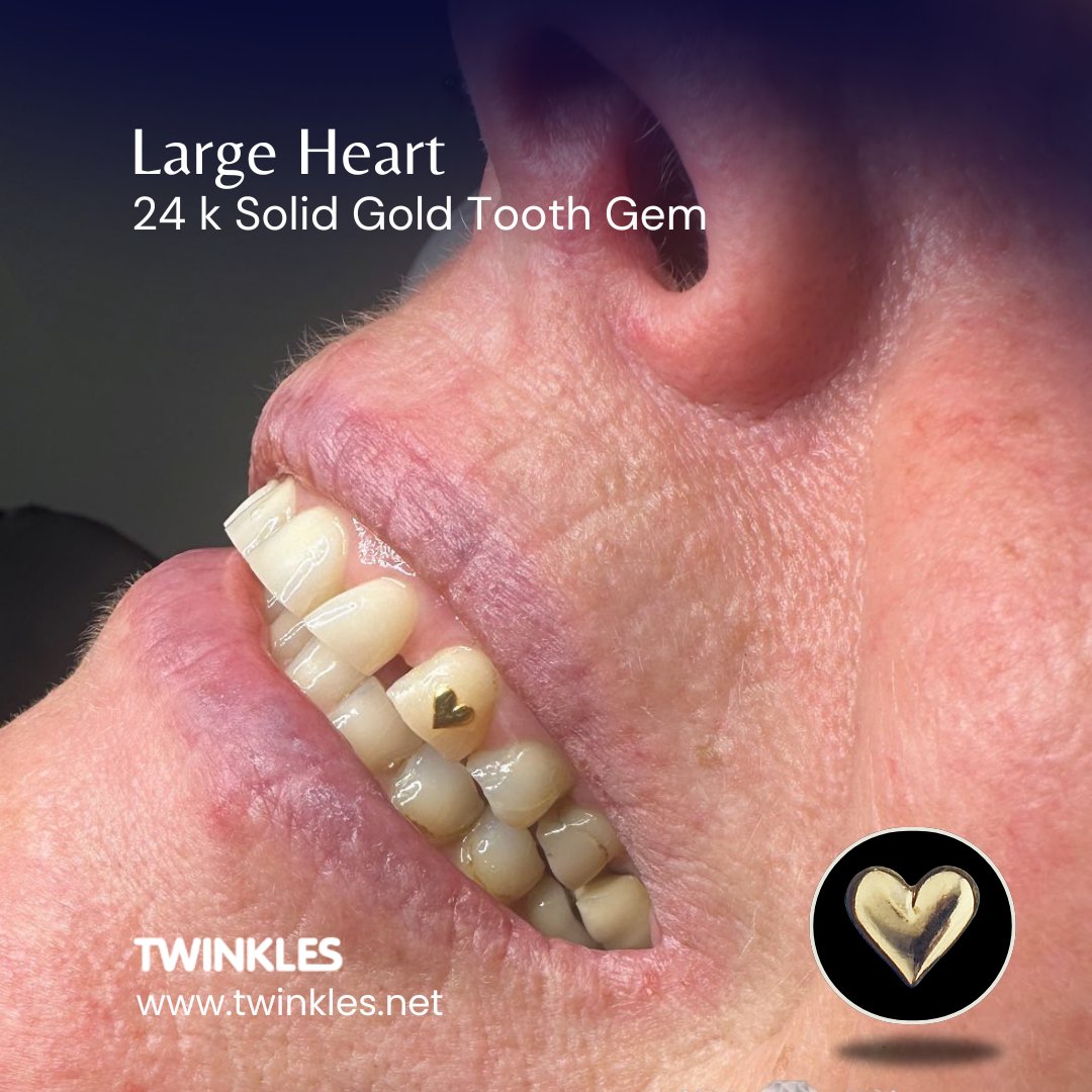 Twinkles Dental Jewelry (@TwinklesJewels) / Posts / X