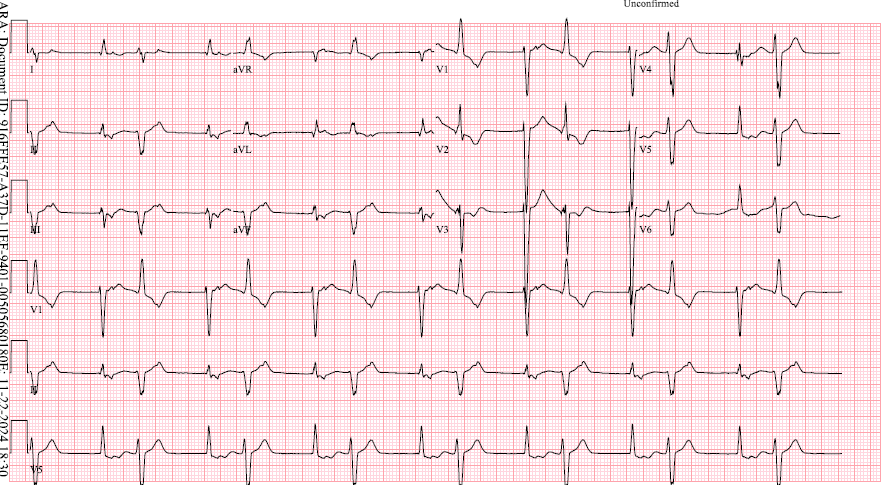 syamkumarmd's tweet photo. Bigemini 😊 Mechanism? #EPeeps #Fellowsfirst https://t.co/J7Gf4BFB5Q