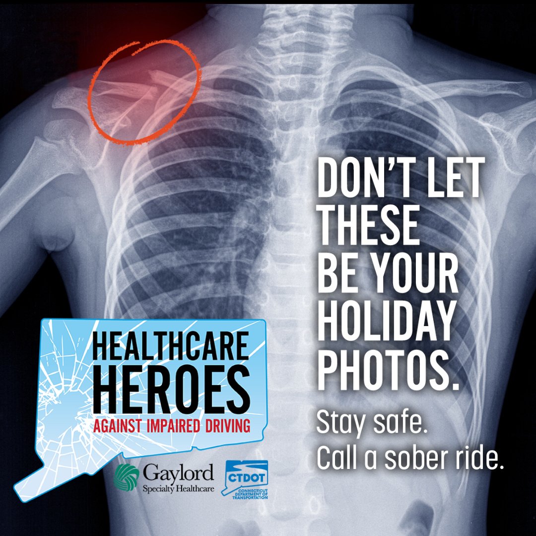 GaylordHealth's tweet photo. This Thanksgiving weekend, let’s focus on making memories—not on injuries. Don’t let x-rays be the highlight of your holiday photos. Stay safe and plan for a sober ride home. Your loved ones want you to celebrate safely!

#ThanksgivingSafety #SoberRides #StaySafe #CTNotOneMore https://t.co/7OoMbTwAzF
