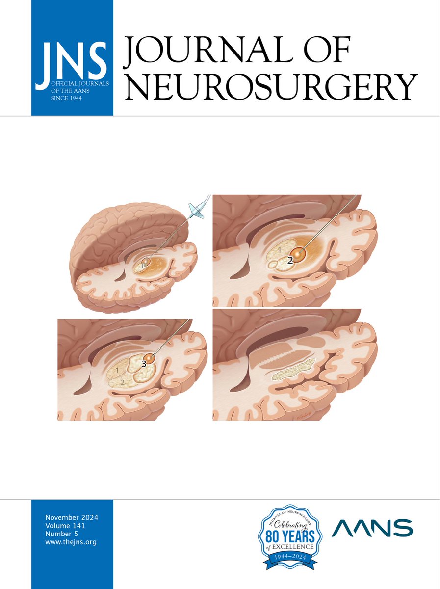 James Rutka (@jamesrutka) on Twitter photo November issue of <a href="/JNSPG_EIC/">EIC of the JNSPG</a> <a href="/TheJNS/">Journal of Neurosurgery</a> illustrates novel role of LITT in challenging cases of insular gliomas! November issue of <a href="/JNSPG_EIC/">EIC of the JNSPG</a> <a href="/TheJNS/">Journal of Neurosurgery</a> illustrates novel role of LITT in challenging cases of insular gliomas!