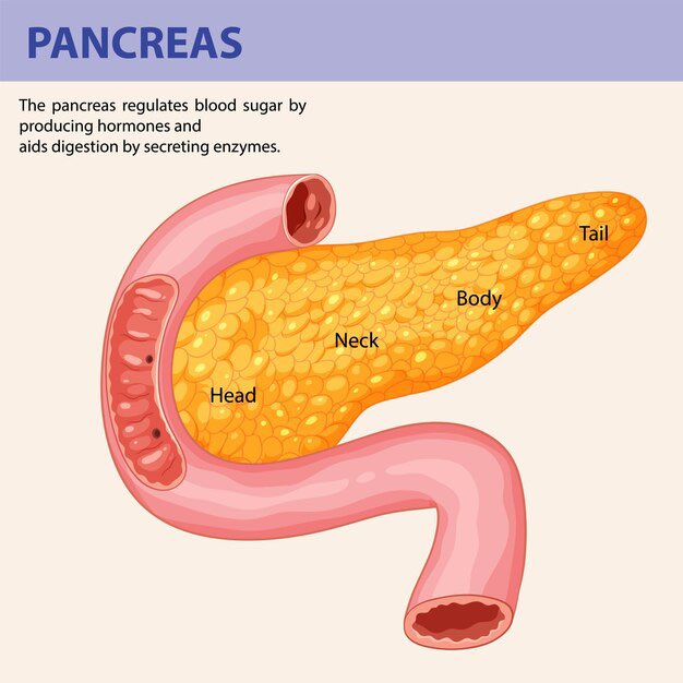 OGreat6's tweet photo. 🔑 PANCREATIC CANCER

Pancreatic cancer signs are often subtle, so it’s good to know them. 

Look out for jaundice (yellowing of the skin and eyes), dark-colored urine, or lighter-colored stools. 

Upper belly pain that may spread to your back, sudden weight loss, and poor appetite are also signals to watch for.