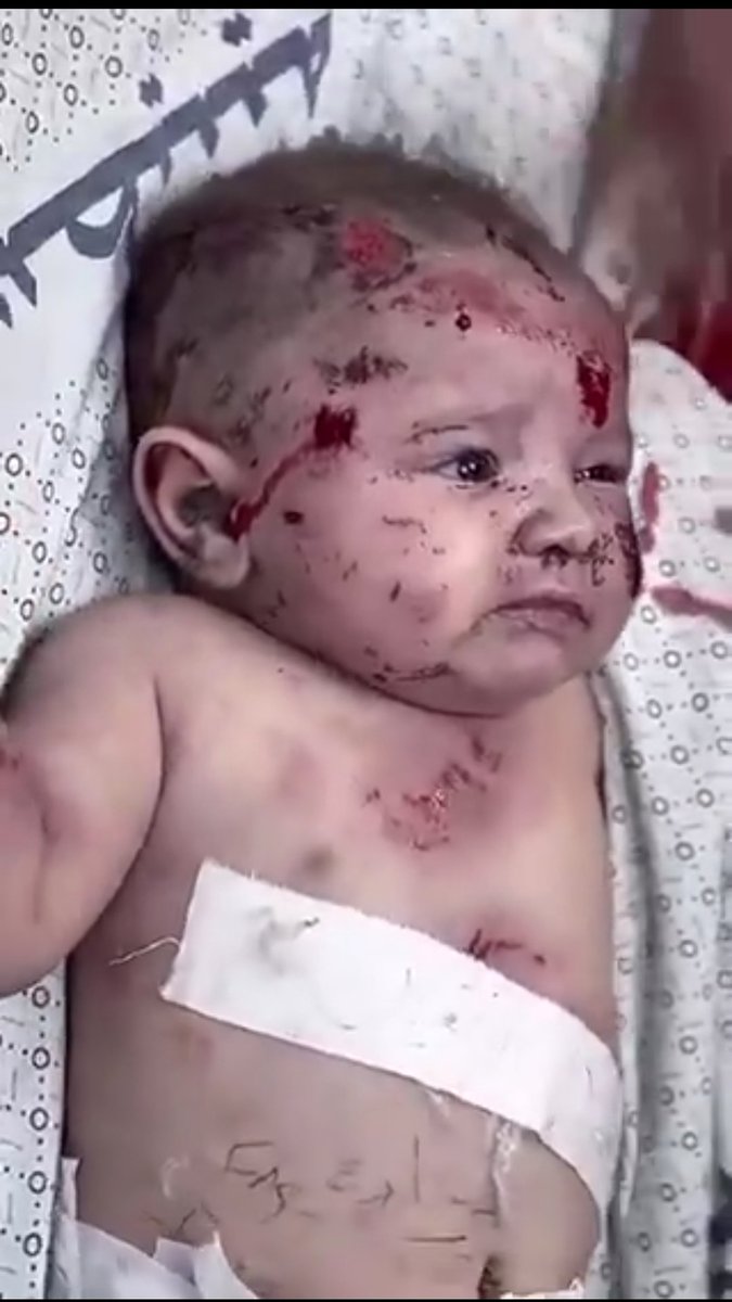 🔻 Vicdan diyorum azizim vicdan.. Her kalbe nasip olmuyor❗
#ShareAPostForGaza