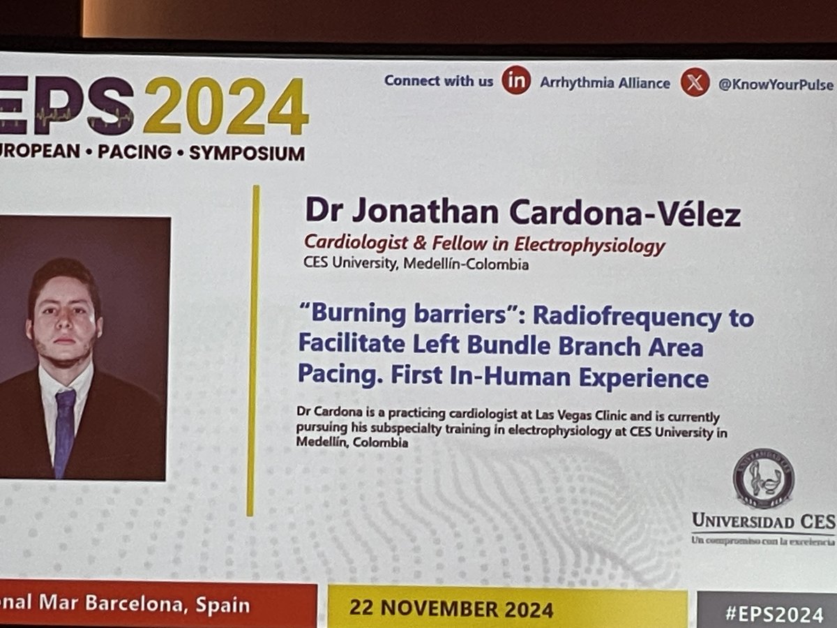 Marek Jastrzębski (@marek_jastrz_ep) on Twitter photo Field is moving so fast! RF powered LBBP lead to overcome septal fibrosis. Just 5 m. since our HRJ publication of the ex vivo model to first in human use of the same method
<a href="/ZacharyWhinnett/">Zachary Whinnett</a>
<a href="/ZanonFrancesco/">Francesco Zanon</a>
<a href="/OCanoPerez/">Óscar Cano</a>
<a href="/MargaridaPujol/">Margarida Pujol Lopez</a>
<a href="/SergioRichterMD/">Sergio Richter</a>
<a href="/MDerndorfer/">Michael Derndorfer</a>
<a href="/kvernooy/">Kevin Vernooy</a> Field is moving so fast! RF powered LBBP lead to overcome septal fibrosis. Just 5 m. since our HRJ publication of the ex vivo model to first in human use of the same method
<a href="/ZacharyWhinnett/">Zachary Whinnett</a>
<a href="/ZanonFrancesco/">Francesco Zanon</a>
<a href="/OCanoPerez/">Óscar Cano</a>
<a href="/MargaridaPujol/">Margarida Pujol Lopez</a>
<a href="/SergioRichterMD/">Sergio Richter</a>
<a href="/MDerndorfer/">Michael Derndorfer</a>
<a href="/kvernooy/">Kevin Vernooy</a>