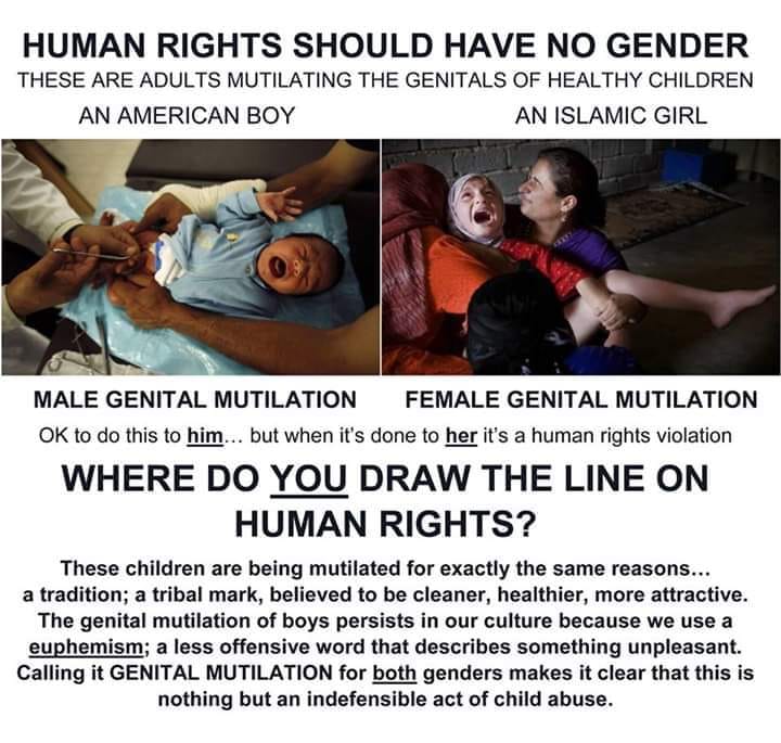 TheGuardianAn15's tweet photo. Typical #BabyCutter's "but #FGM is much worse" argument falls flat in the light of day.
https://t.co/AohnVhKygT
Policies, and even laws, are being changed regarding some forms of female genital cutting on minors, in order for male circumcision to remain legal...
See ALT! https://t.co/X6ld1Pb3wZ