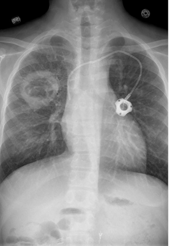 Alexander Mendieta, MD tweet media