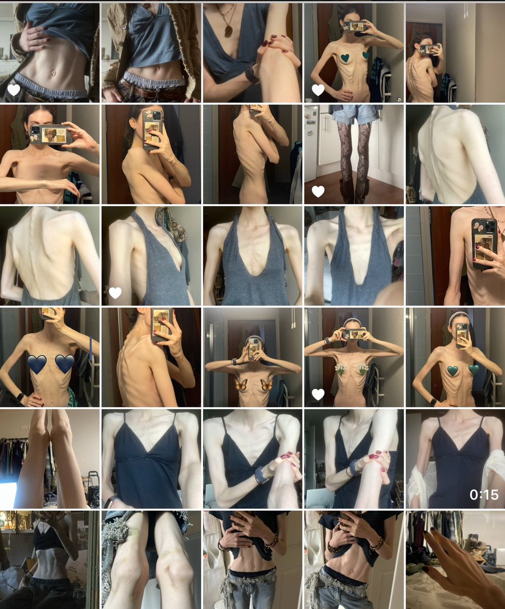 ghostoftine's tweet photo. Psychiatrist: Do you body check?

Me: No…

My camera roll: https://t.co/fIbxS8lf7Y