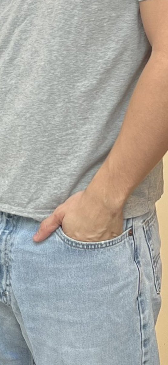 Gnard_Dawg's tweet photo. @LudwigAhgren Why tf your left thumb look like that https://t.co/xW4AQXg85t