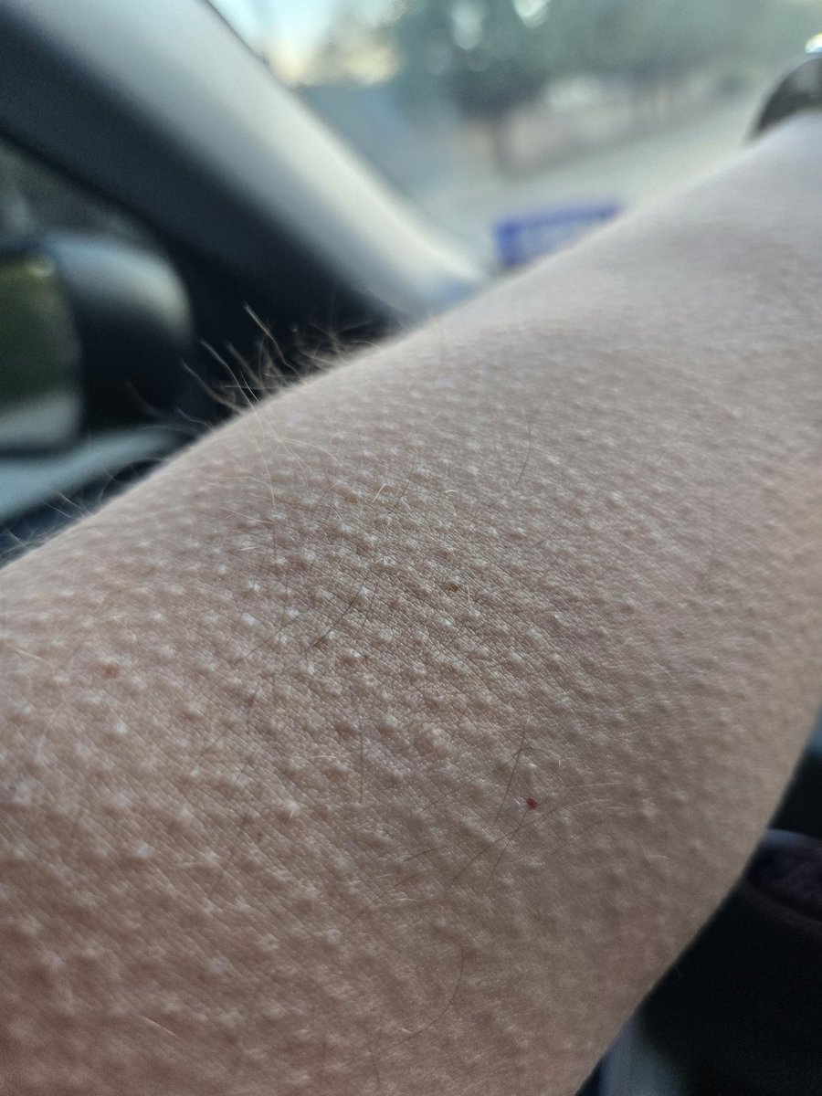 Adam Drake tweet media