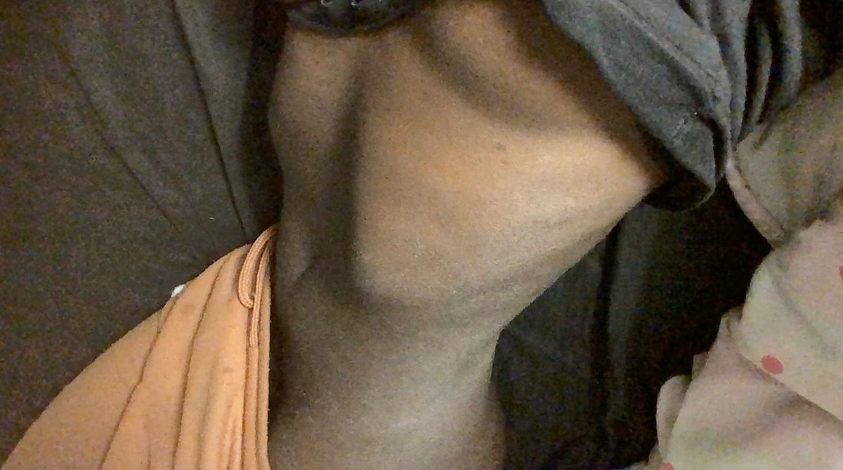 thinspoflix tweet media